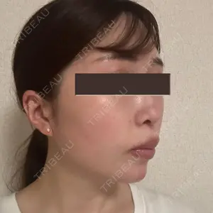 EMMO FACE CLINIC EMMO FACE CLINIC 大宮院口コミ