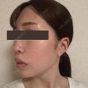 EMMO FACE CLINIC EMMO FACE CLINIC 大宮院口コミ