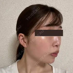 EMMO FACE CLINIC EMMO FACE CLINIC 大宮院口コミ