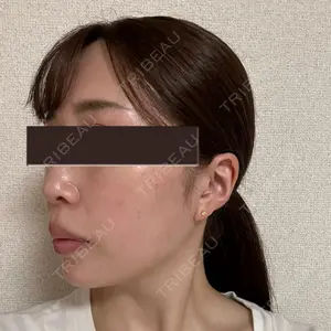 EMMO FACE CLINIC EMMO FACE CLINIC 大宮院口コミ