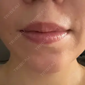 BON BON CLINIC BON BON CLINIC 銀座駅前本院口コミ