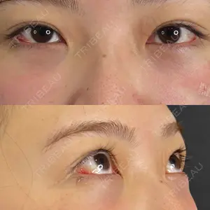藤・ナチュレ美容クリニック 藤・ナチュレ美容クリニック 銀座院口コミ