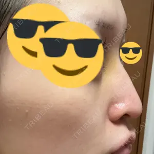 YBC横浜美容外科 YBC横浜美容外科 立川院口コミ