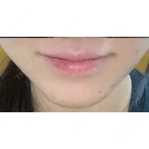 フィラークリニック フィラークリニック 町田院口コミ