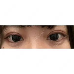 東京イセアクリニック口コミ
