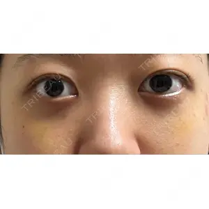 APOLLO BEAUTY CLINIC口コミ