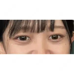 APOLLO BEAUTY CLINIC口コミ
