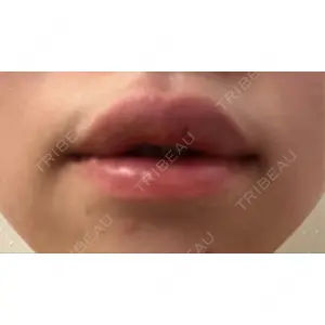 口コミ