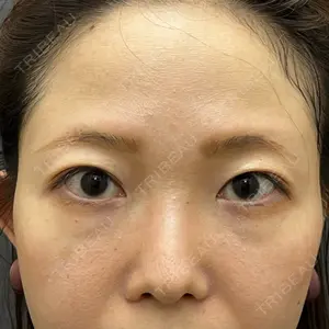渋谷の森クリニック口コミ