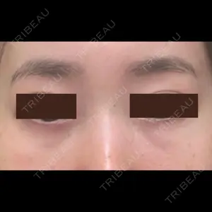 APOLLO BEAUTY CLINIC口コミ