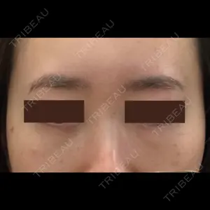 APOLLO BEAUTY CLINIC口コミ