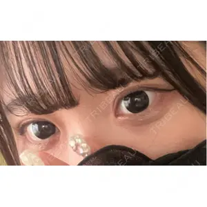 東京イセアクリニック口コミ