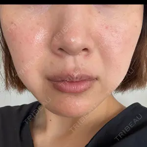 Rinato Beauty Clinic口コミ