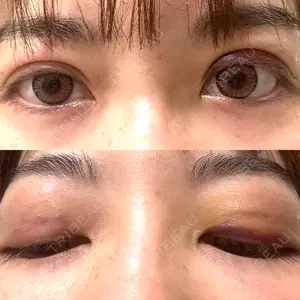 口コミ