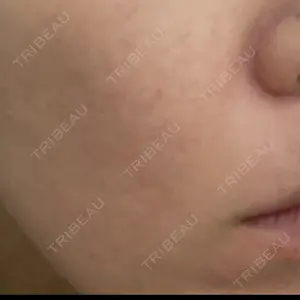 GAYA body design clinic口コミ