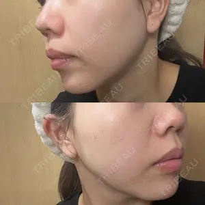 DAILY SKIN CLINIC 福岡院口コミ