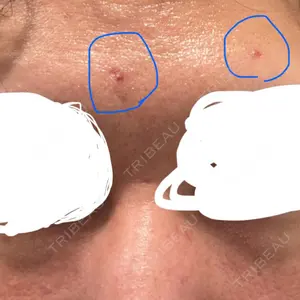 Fellez Clinic【フェルズクリニック】口コミ