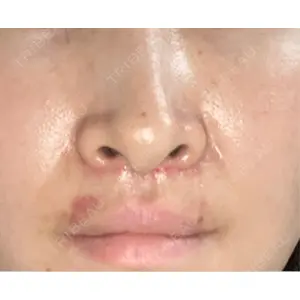 くさのたろうクリニック口コミ