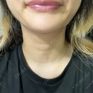 TCB東京中央美容外科 TCB東京中央美容外科 横浜院口コミ