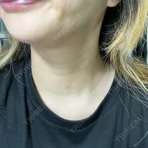 TCB東京中央美容外科 TCB東京中央美容外科 横浜院口コミ