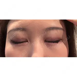 プロミス整形外科口コミ
