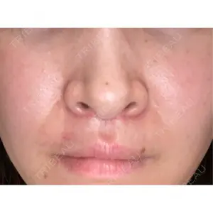 くさのたろうクリニック口コミ
