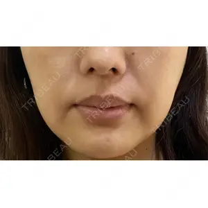 PRISM Beauty Clinic  PRISM Beauty Clinic 町田院口コミ