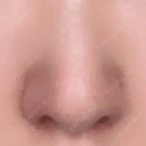 GLANZ CLINIC口コミ