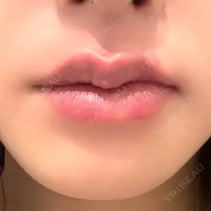 R Beauty CLINIC R Beauty CLINIC 銀座院口コミ