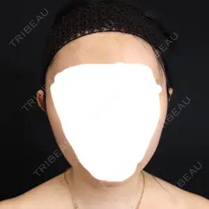藤・ナチュレ美容クリニック 藤・ナチュレ美容クリニック 銀座院口コミ