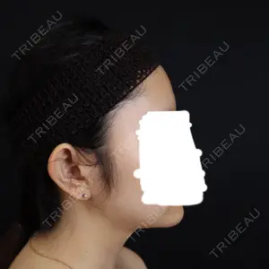 藤・ナチュレ美容クリニック 藤・ナチュレ美容クリニック 銀座院口コミ