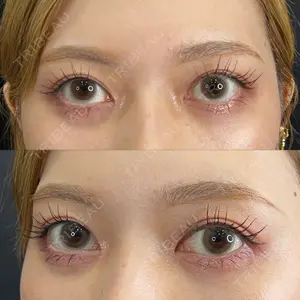 藤・ナチュレ美容クリニック 藤・ナチュレ美容クリニック 銀座院口コミ