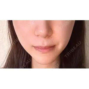 口コミ