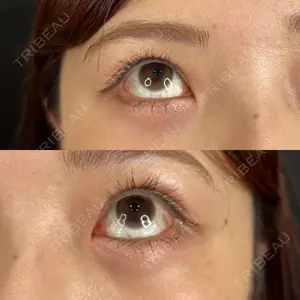 藤・ナチュレ美容クリニック 藤・ナチュレ美容クリニック 銀座院口コミ