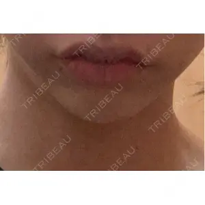 R Beauty CLINIC R Beauty CLINIC 銀座院口コミ