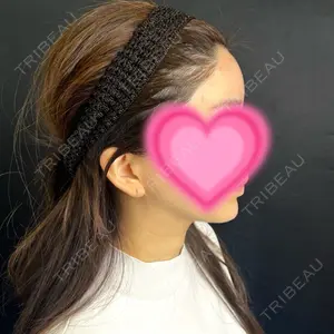 藤・ナチュレ美容クリニック 藤・ナチュレ美容クリニック 銀座院口コミ