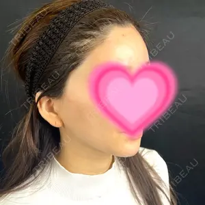 藤・ナチュレ美容クリニック 藤・ナチュレ美容クリニック 銀座院口コミ