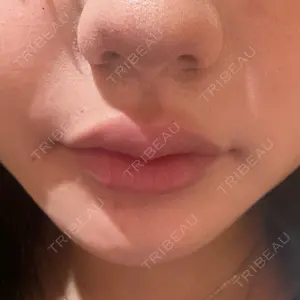R Beauty CLINIC R Beauty CLINIC 銀座院口コミ