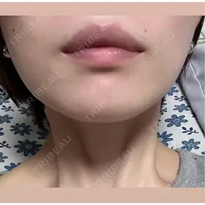 BiBiクリニック口コミ