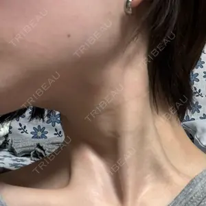 BiBiクリニック口コミ