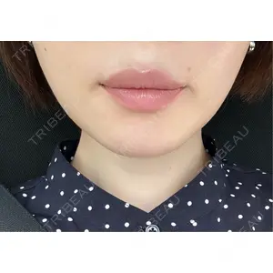 BiBiクリニック口コミ