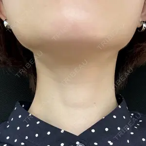 BiBiクリニック口コミ