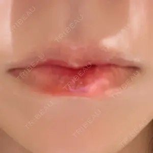 R Beauty CLINIC R Beauty CLINIC 銀座院口コミ