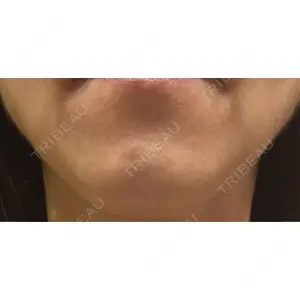 BON BON CLINIC BON BON CLINIC 銀座駅前本院口コミ