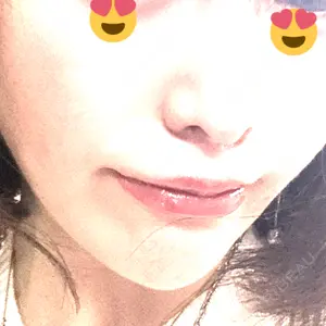 口コミ