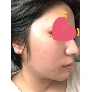 Re:anne clinic 銀座 【リアンクリニック銀座】口コミ