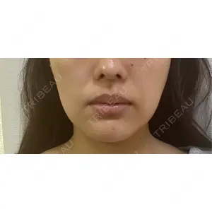 PRISM Beauty Clinic  PRISM Beauty Clinic 町田院口コミ