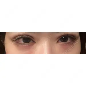 口コミ