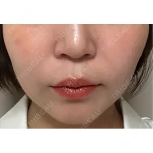 表参道メディカルクリニック 表参道メディカルクリニック 銀座院口コミ