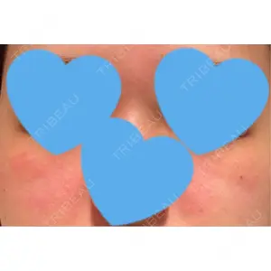 聖心美容クリニック グループ S-Laboクリニック 渋谷院口コミ